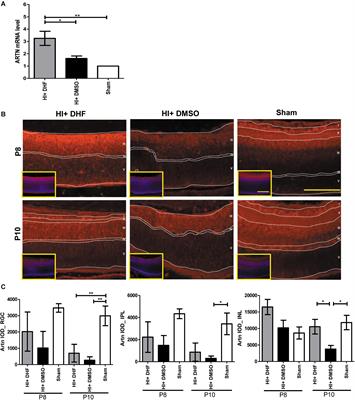 Artemin Is Upregulated by TrkB Agonist and Protects the Immature Retina Against Hypoxic-Ischemic Injury by Suppressing Neuroinflammation and Astrogliosis
